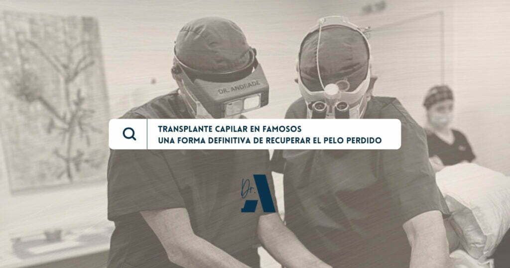 trasplante capilar en famosos