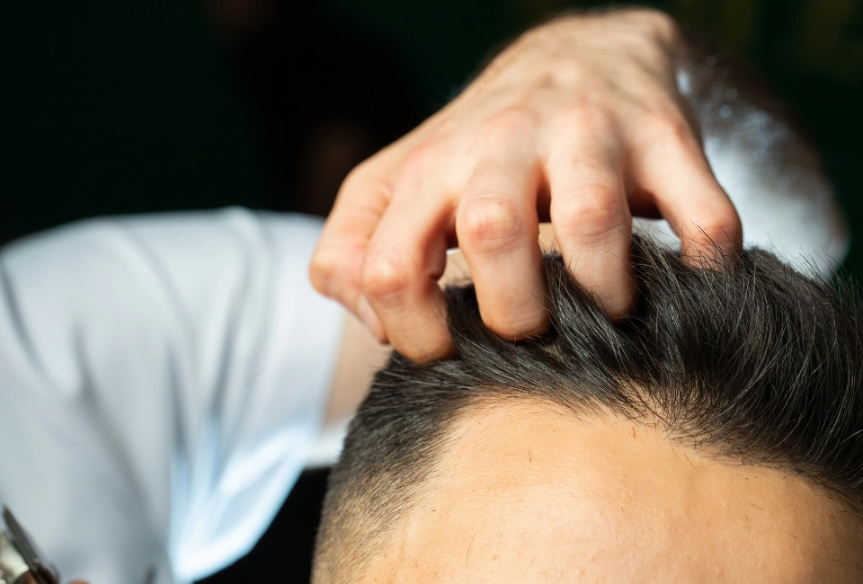Cuánto dura un trasplante de pelo y cómo mantenerlo