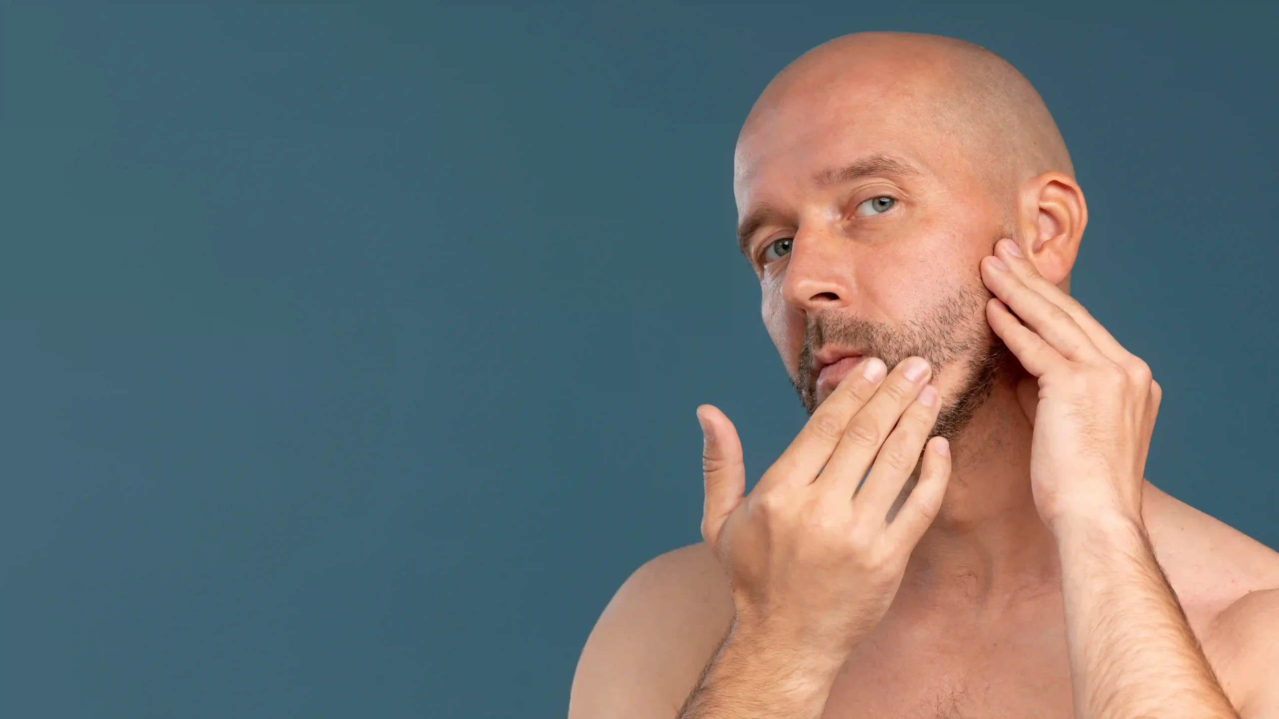 Alopecia areata en barba: causas y tratamiento