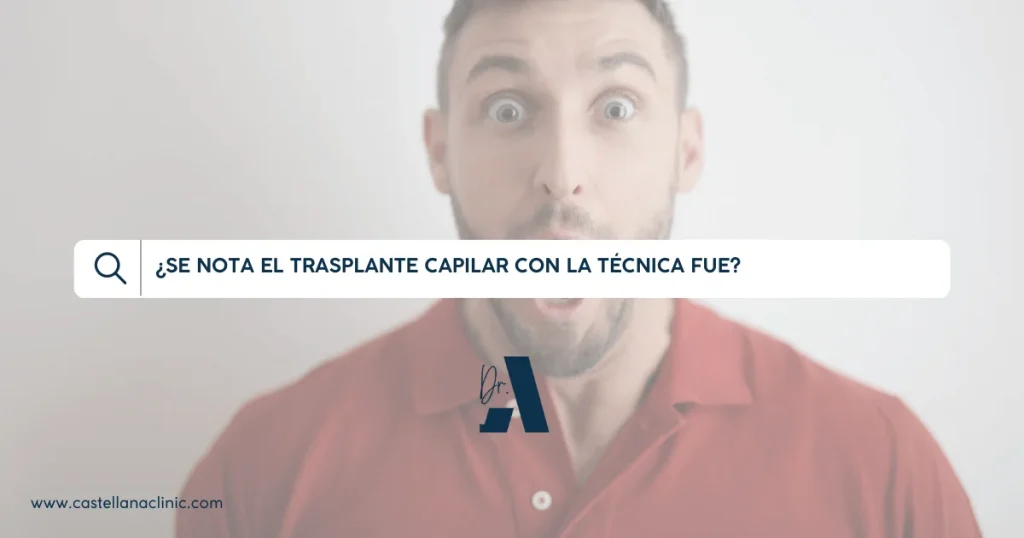¿se nota el trasplante capilar con la tecnica fue?