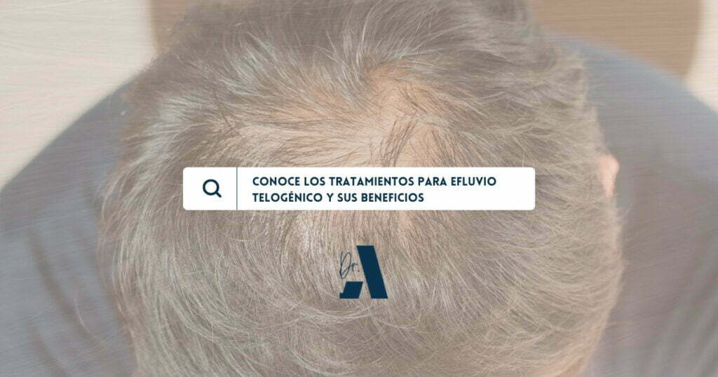 beneficios tratamiento para efluvio telogénico