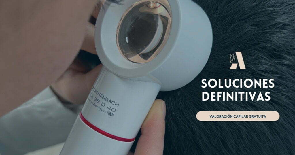 tratamientos efluvio telogénico