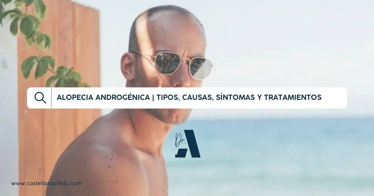 Alopecia Androgénica: ¿Qué es? | Tipos, Causas, Síntomas y Tratamientos