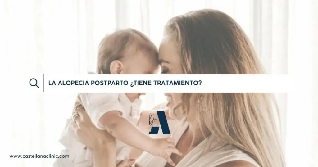 alopecia postparto