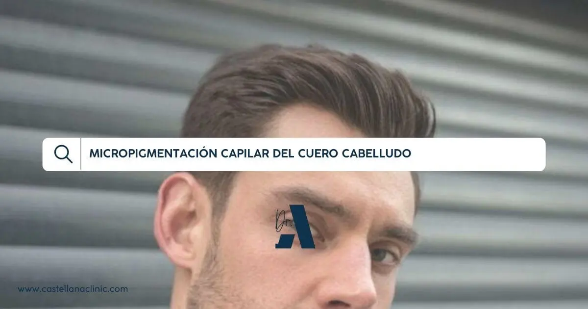 Micropigmentacion capilar del cuero cabelludo