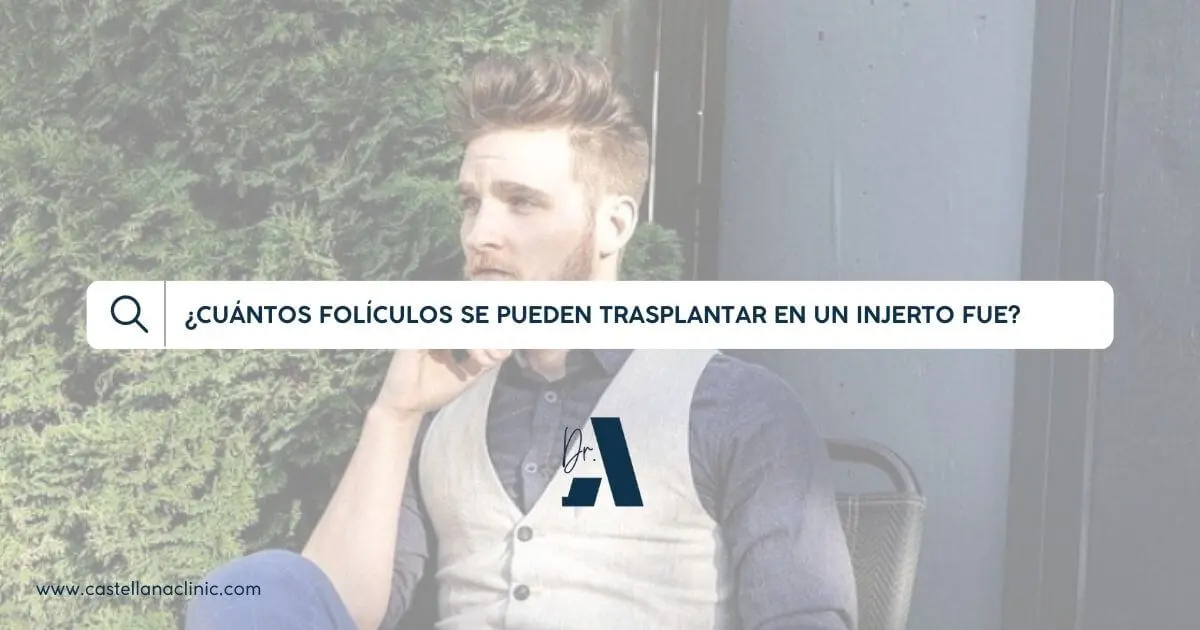 ¿Cuántos folículos se pueden transplantar en un injerto FUE?