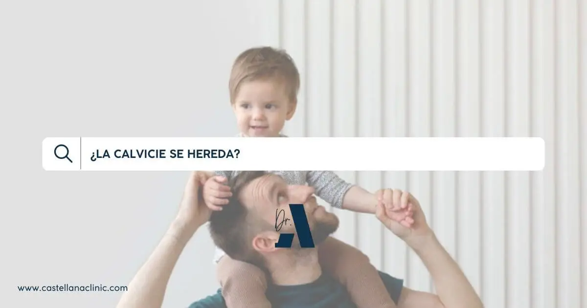 ¿La calvicie se hereda? | Alopecia hereditaria