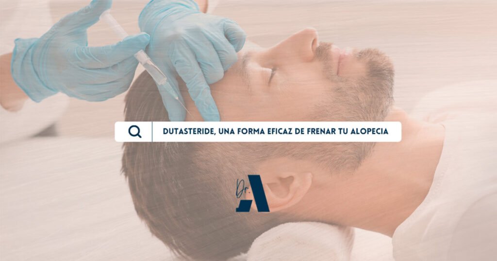 Hombre utilizando dutasteride, un tratamiento contra la alopecia.