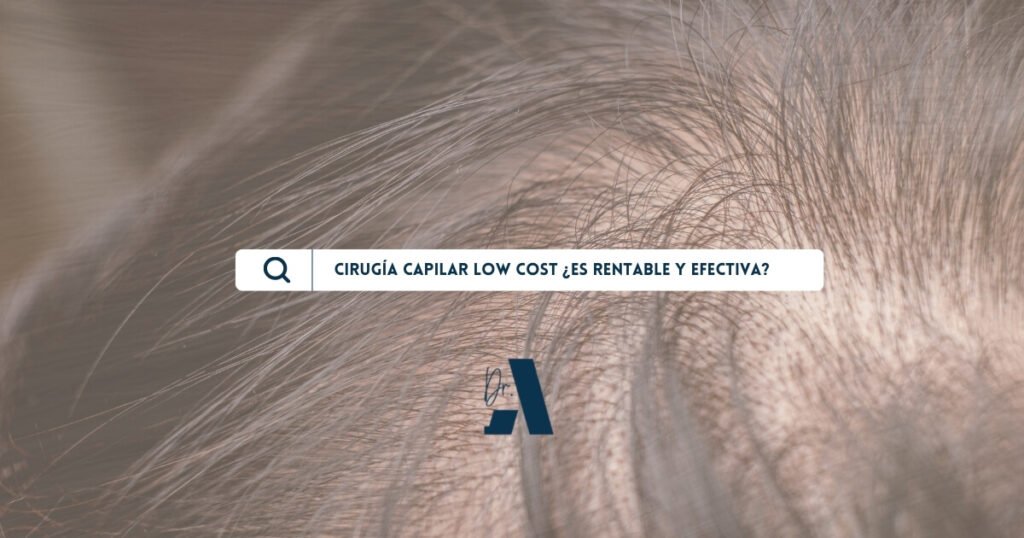 Cirugía Capilar Low Cost en Turquía