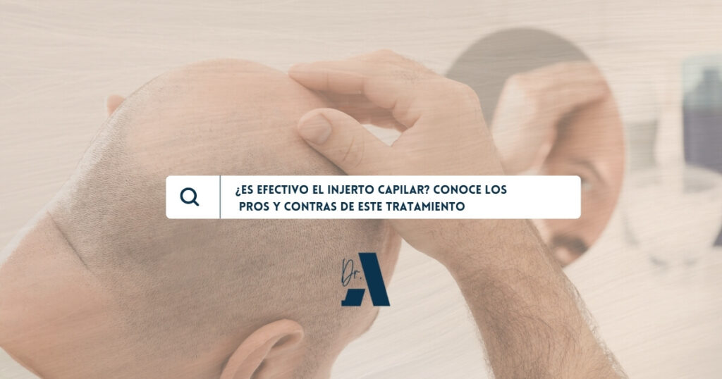 injerto capilar pros y contras castellana clinic