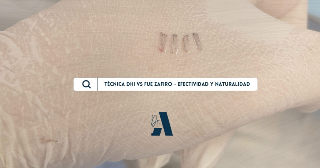 diferencia tecnica dhi fue zafiro