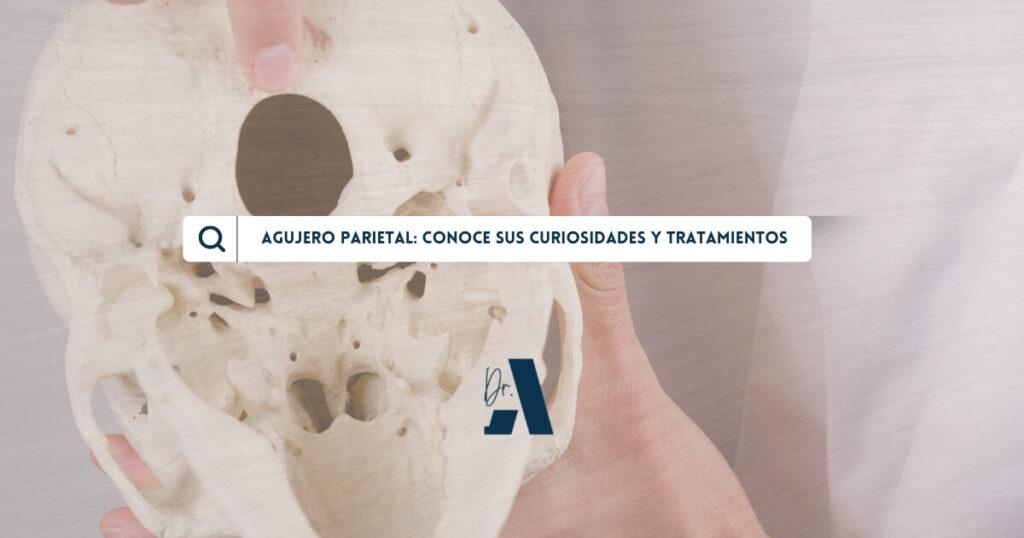 Agujero parietal
