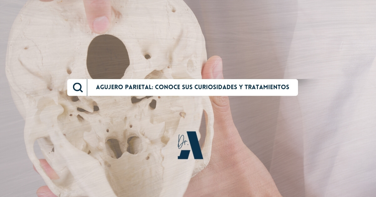 Agujero parietal: Conoce sus curiosidades y tratamientos