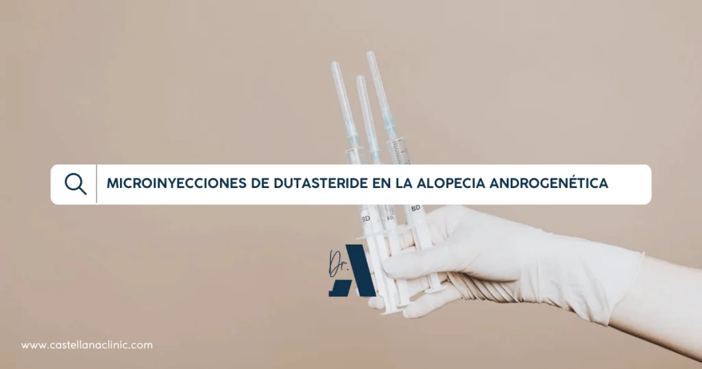MICROINYECCIONES DE DUTASTERIDE EN LA ALOPECIA ANDROGENETICA