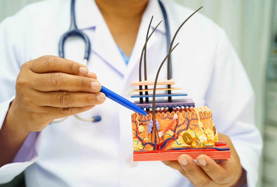 El daño por isquemia reperfusión en el injerto capilar