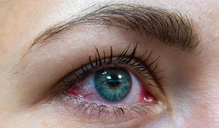 Los riesgos de la extensión de pestañas y su impacto en la salud ocular