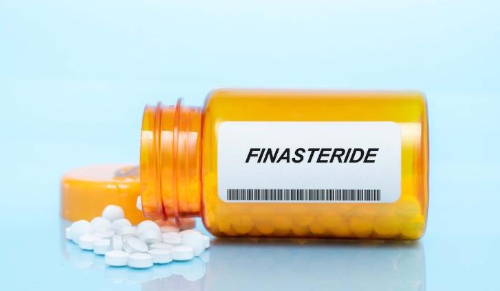 ¿Qué es el síndrome post finasteride?